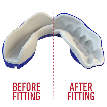 SAFEJAWZ Extro Series Shark Self Fit Mouthguards - Blue